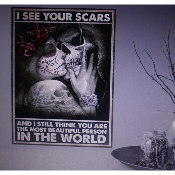 I See Your Scars & I Still Think You Are The Most Beautiful Person Canvas Print - Picture 1 of 3